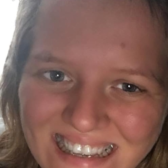 Free toothpaste - Picture 1 of 3